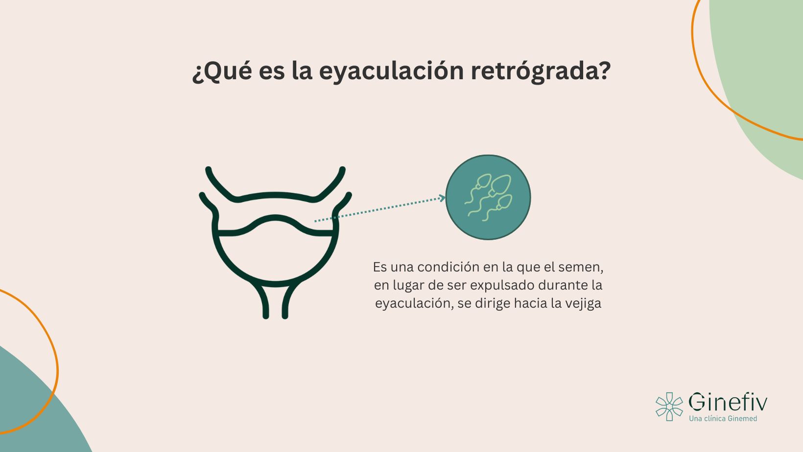 eyaculación retrógrada y fertilidad masculina