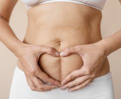 El istmocele afecta a mujeres que se han sometido a una cesárea